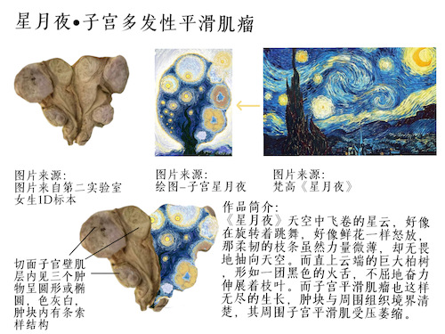 临床2106吴翊翔- 星月夜